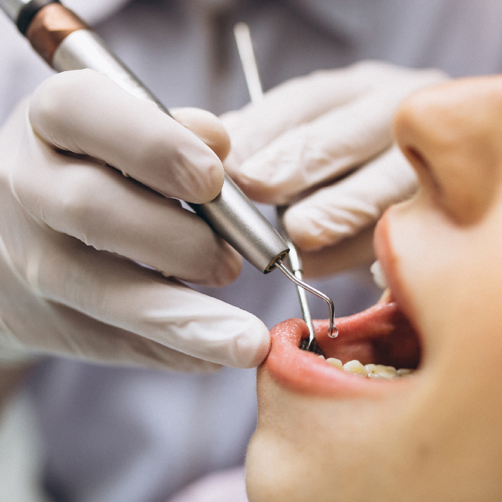 Beneficio dental